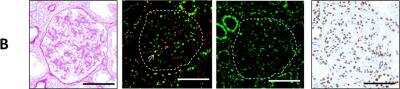 Immunohistochemical Staining of Histone H2AX in Human Kidney Tissue